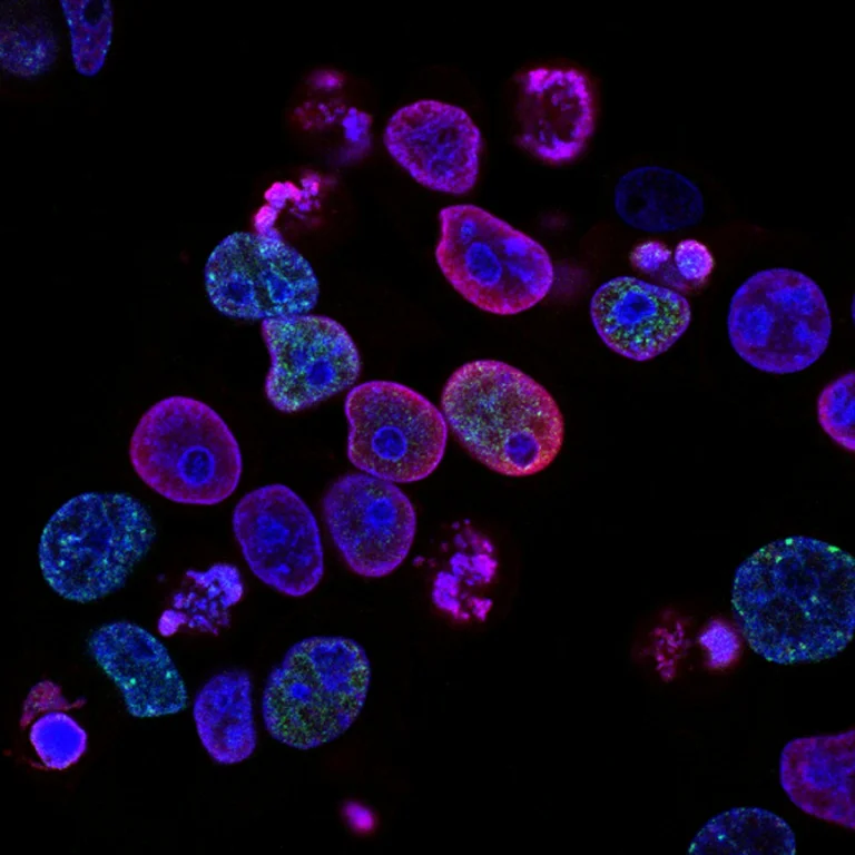 MPhil in Infections and Immunity