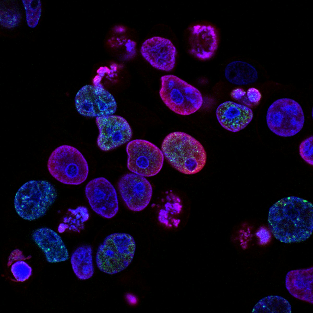 MPhil in Infections and Immunity